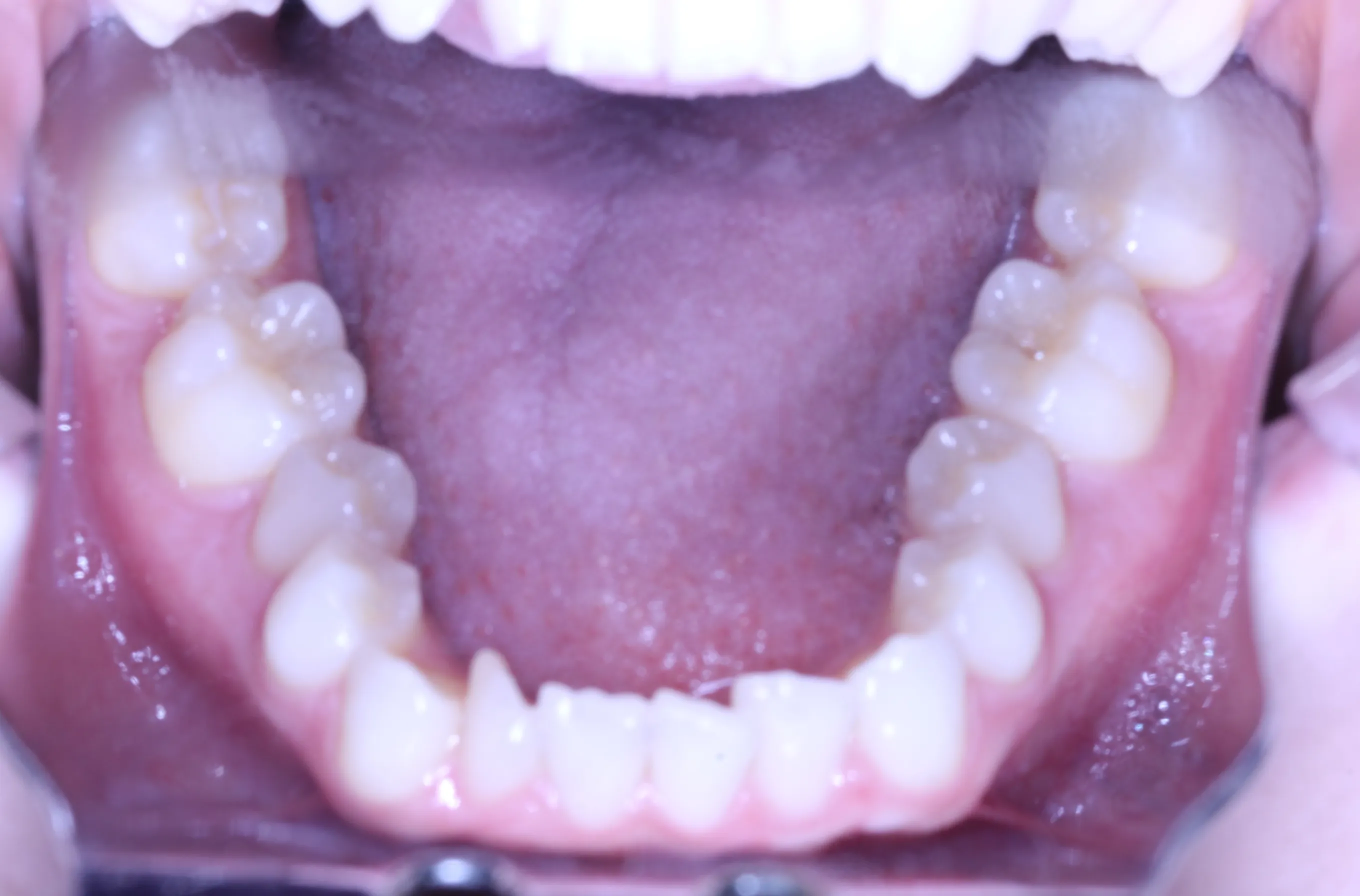 smile-gallery gallery